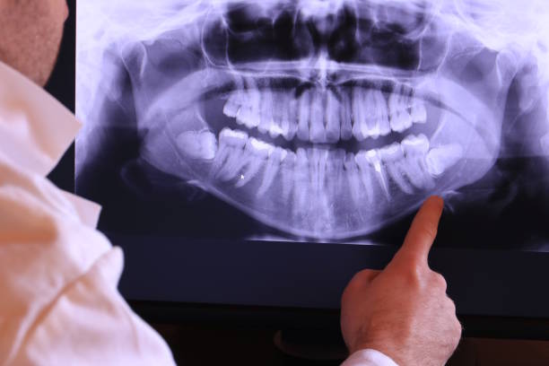 Best Emergency Dental Surgery in New Oxford, PA