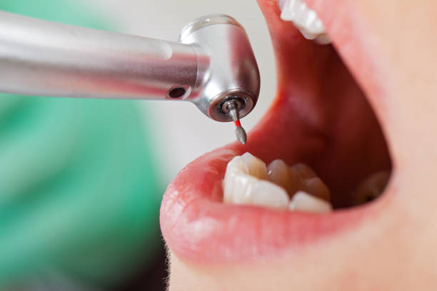 Best Emergency Tooth Extraction in New Oxford, PA